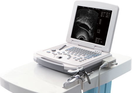 超導(dǎo)可視無(wú)痛人流機(jī),可視無(wú)痛人流機(jī),可視人流機(jī),可視人流b超機(jī),