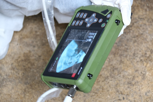 掌上B超機檢測圖